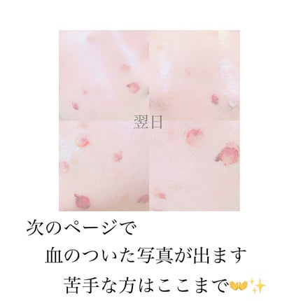 を使ったクチコミ(2枚目)