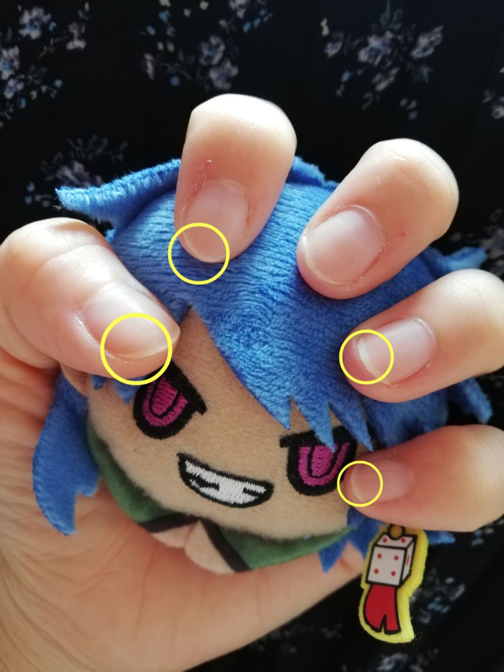 フレグランスネイルオイル ピュアシャンプーの香り フィアンセの口コミ 前回上げた爪甲剥離症の記事から約2週間程経ちましたので経過報告致します By キモオタ 乾燥肌 30代前半 Lips フレグランスネイルオイル ピュアシャンプーの香り フィアンセの口コミ 前回上げた爪甲剥離症の記事から約2週間程経ちましたので経過報告致します By キモオタ 乾燥肌 30代前半 Lips