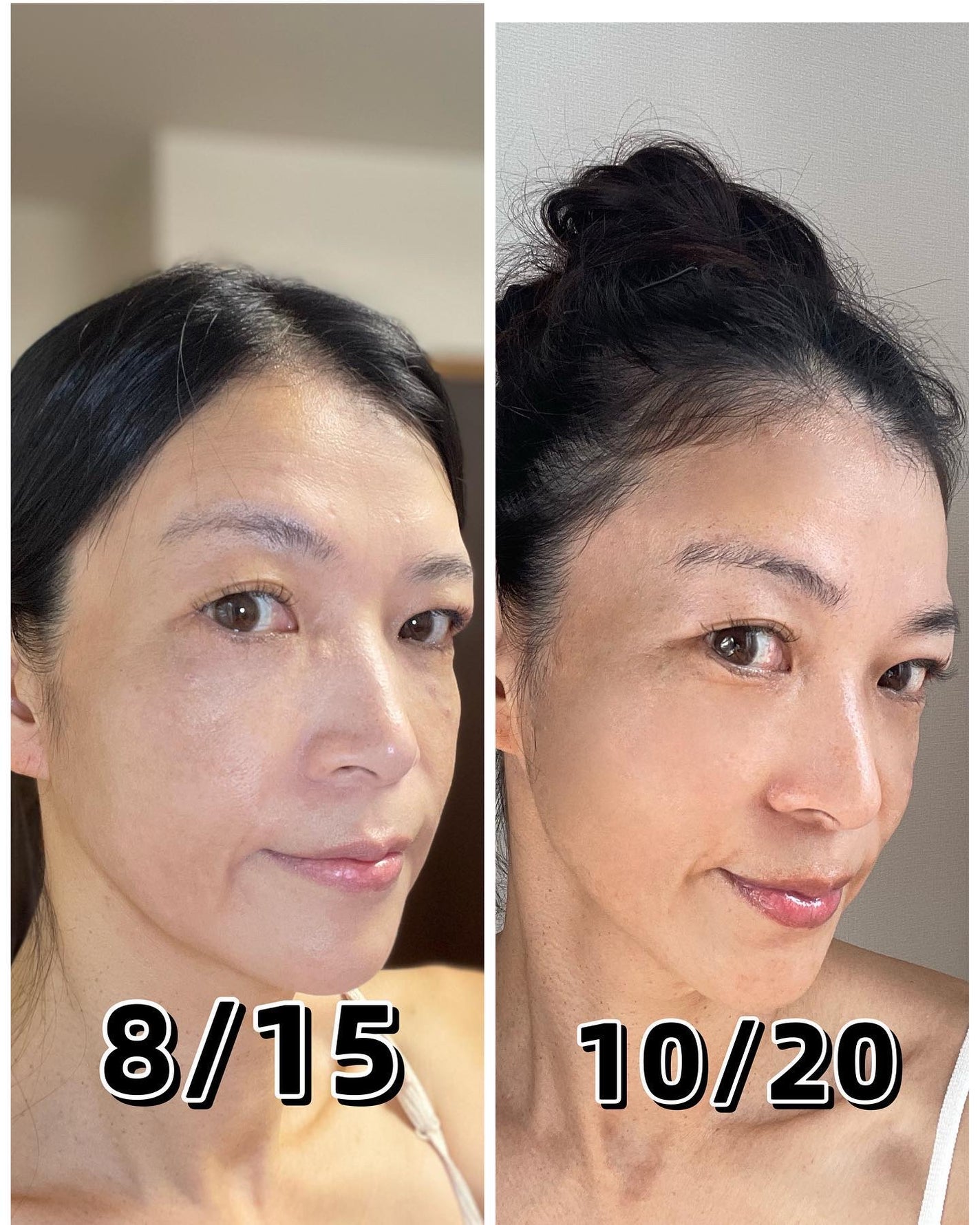 エクスイディアル オーヴォ/エクスイディアル/美顔器・マッサージを使ったクチコミ(2枚目)