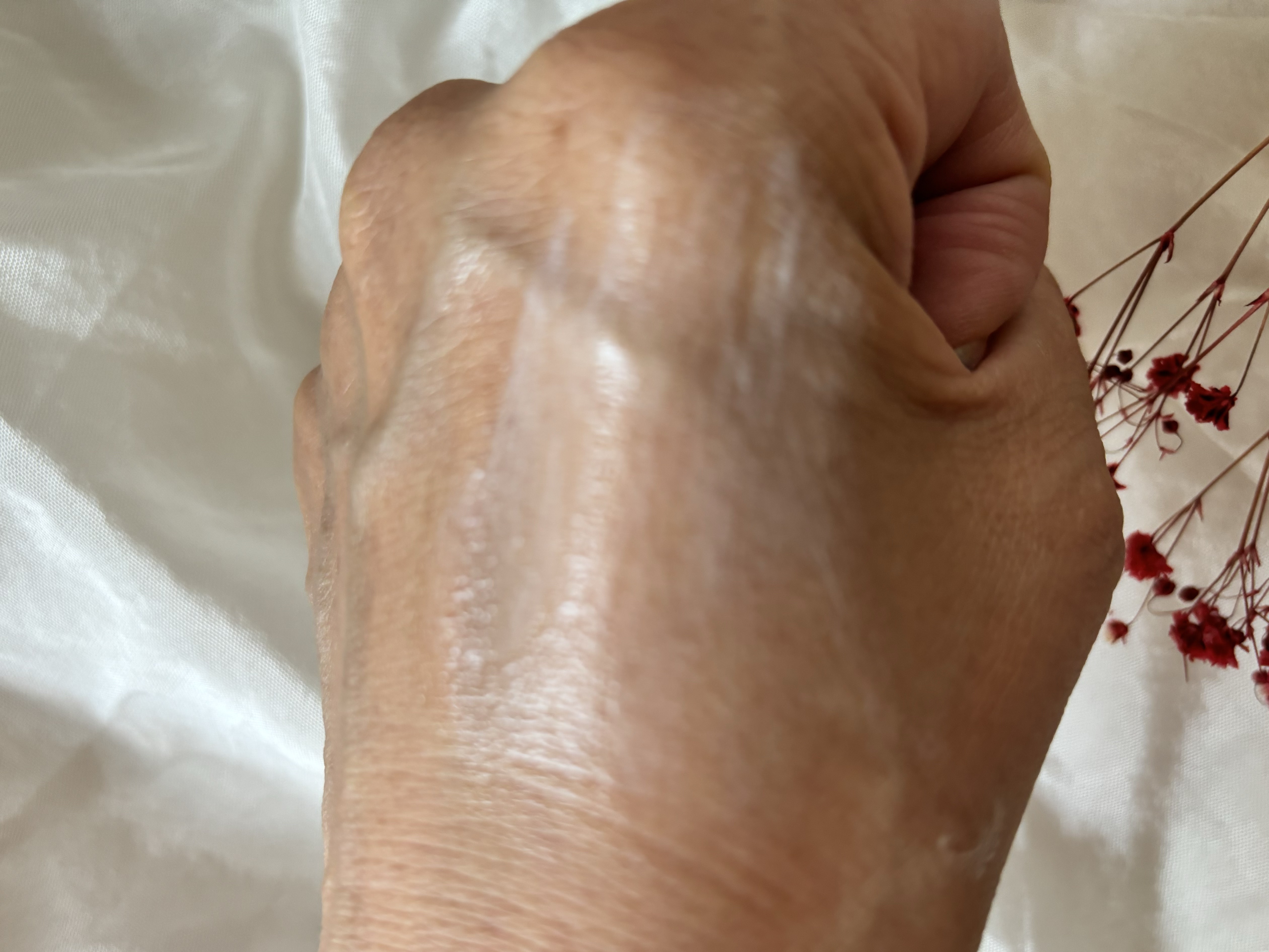 レッドスージングAIクリーム/PHYSIOGEL/フェイスオイルを使ったクチコミ（3枚目）