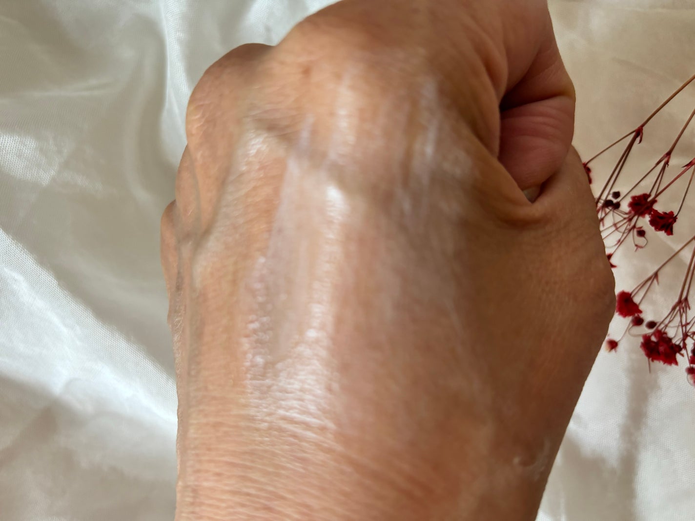 レッドスージングAIクリーム/PHYSIOGEL/フェイスオイルを使ったクチコミ(3枚目)