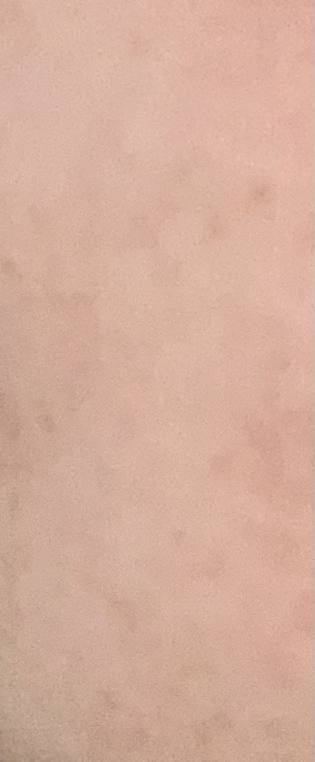 薬用美白化粧水/DAISO/化粧水を使ったクチコミ（3枚目）