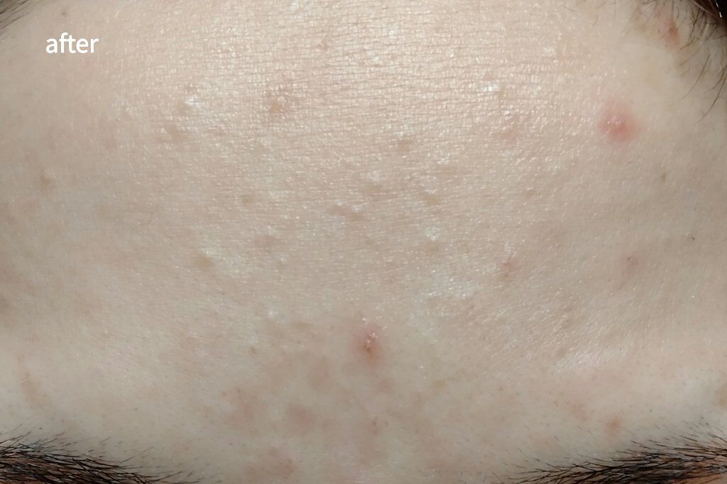 リンクル化粧水 Ｎ/なめらか本舗/化粧水を使ったクチコミ（3枚目）