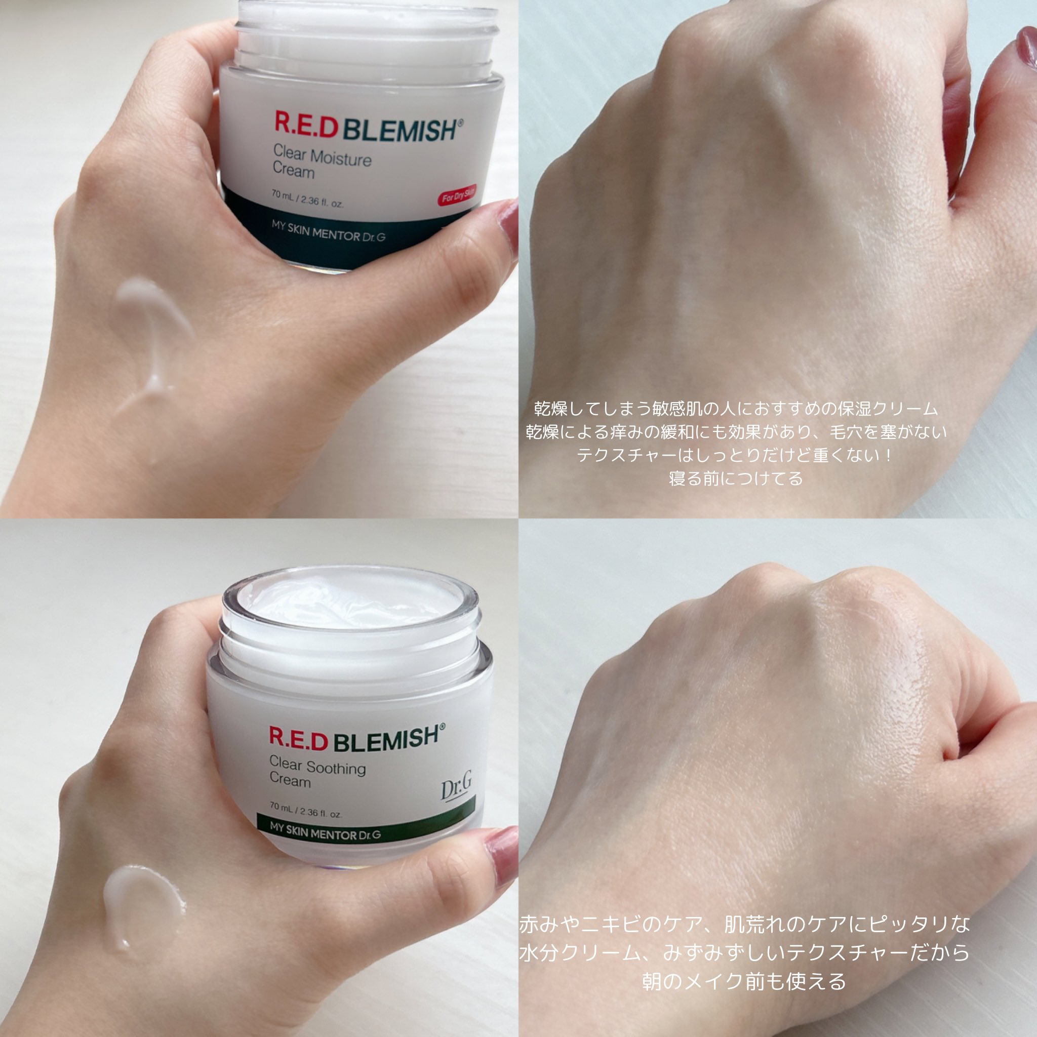レッドブレミッシュ クリアモイスチャークリーム/Dr.G/フェイスクリームを使ったクチコミ（3枚目）