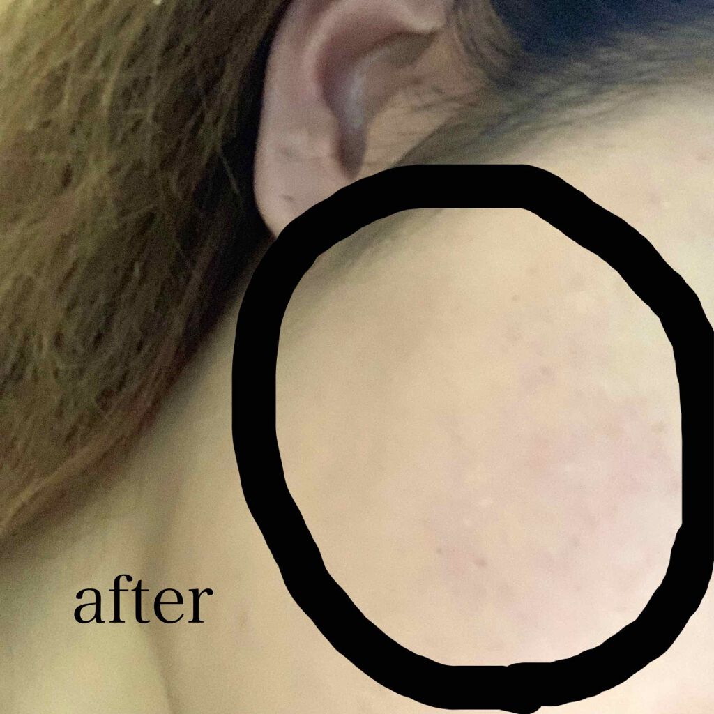 パウダリースキンメイカー/KATE/リキッドファンデーションを使ったクチコミ(3枚目)