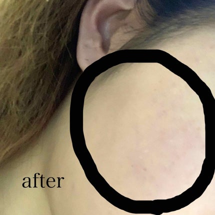 パウダリースキンメイカー/KATE/リキッドファンデーションを使ったクチコミ(3枚目)