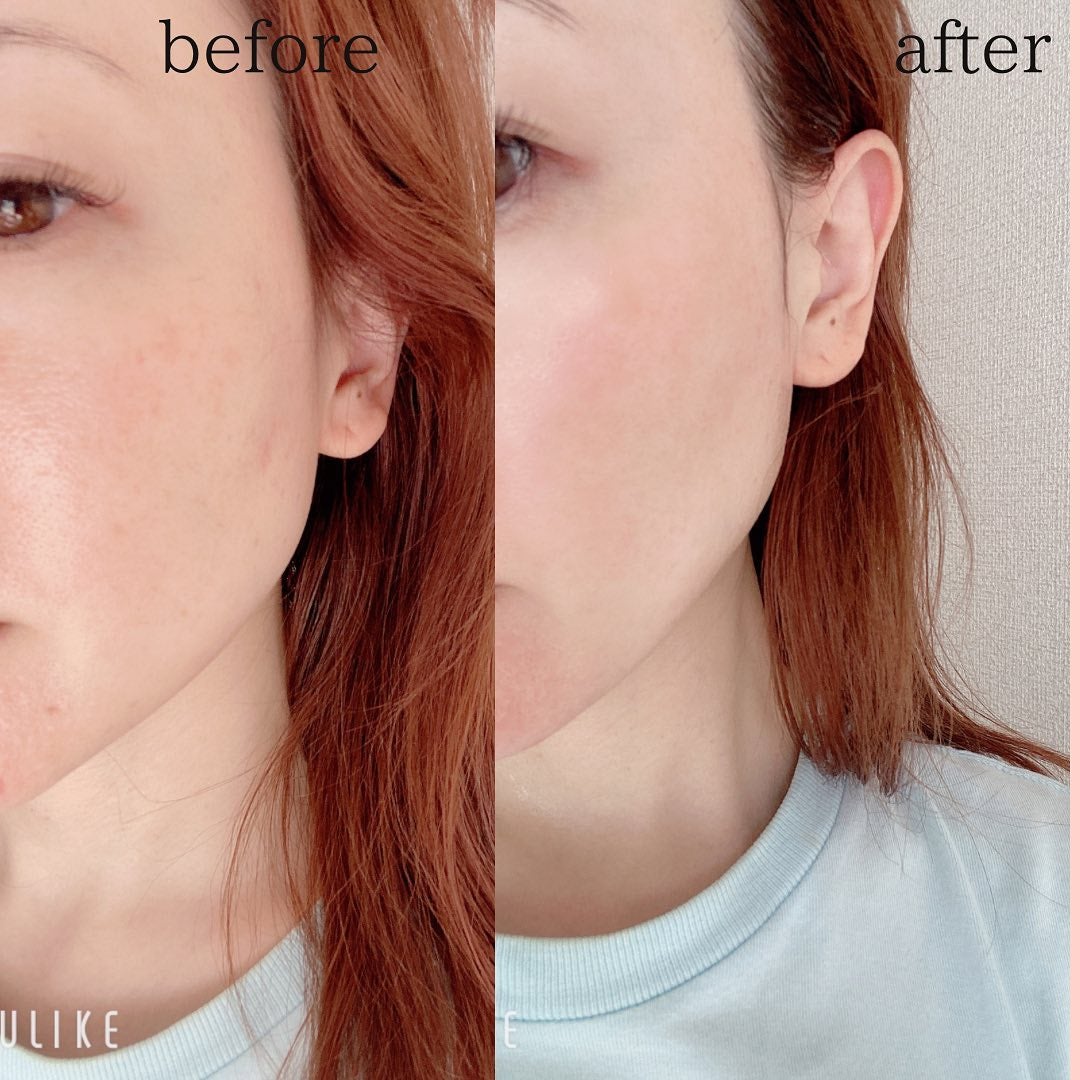 CICA クリーム/VT/フェイスクリームを使ったクチコミ(2枚目)