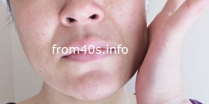 シルクセラム/エルツティン/美容液を使ったクチコミ(4枚目)