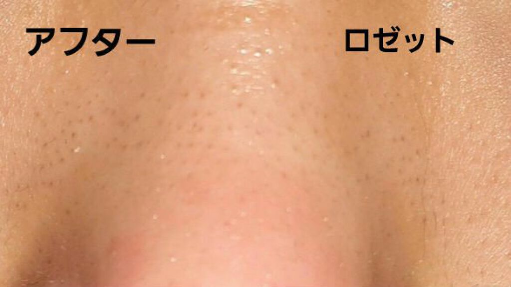 ロゼットゴマージュ/ロゼット/ピーリングを使ったクチコミ(5枚目)