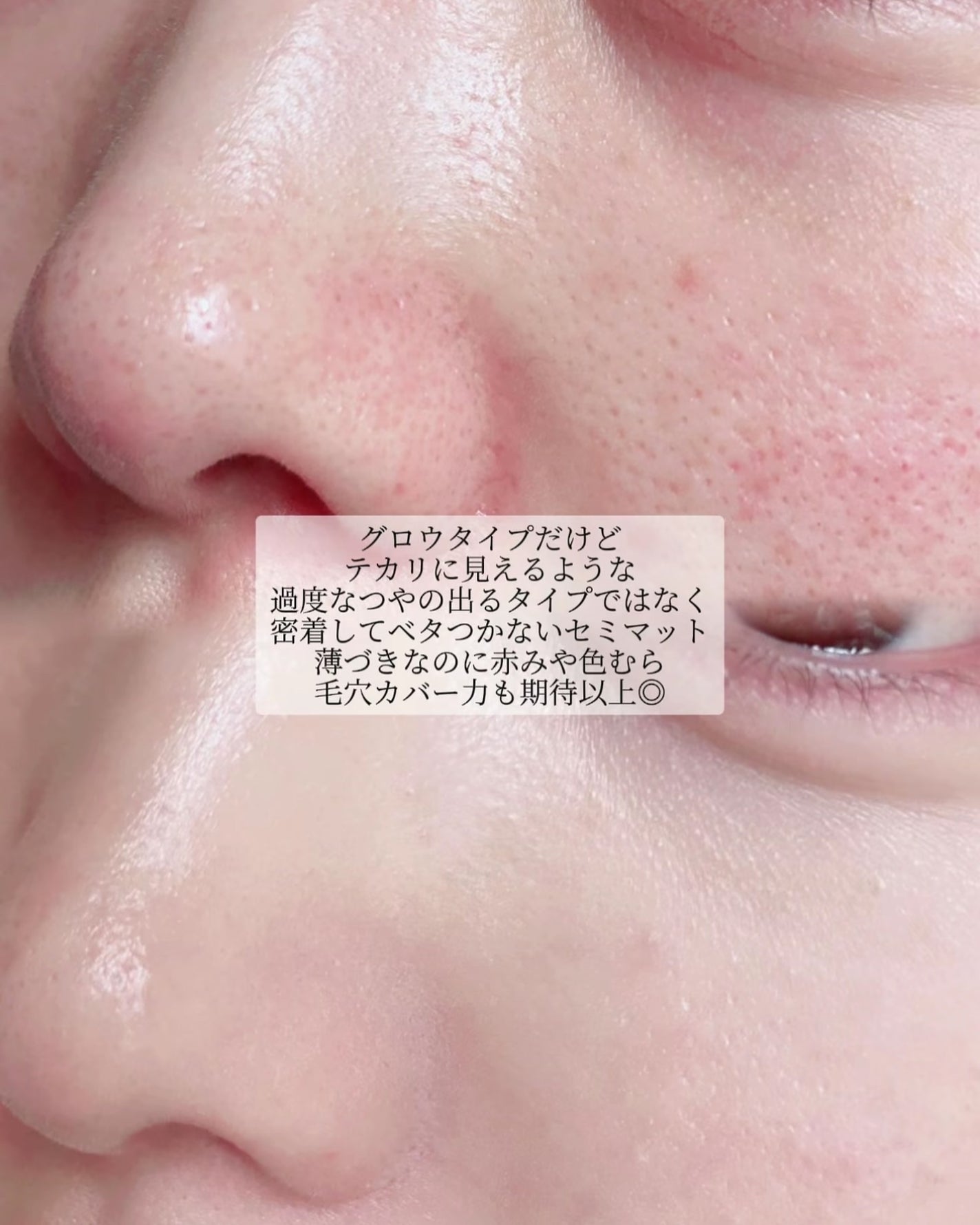 Skin Barrier Calming Lotion/Ongredients/乳液を使ったクチコミ(5枚目)