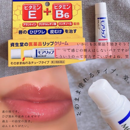 モアリップ N (医薬品)/資生堂薬品/その他を使ったクチコミ(2枚目)