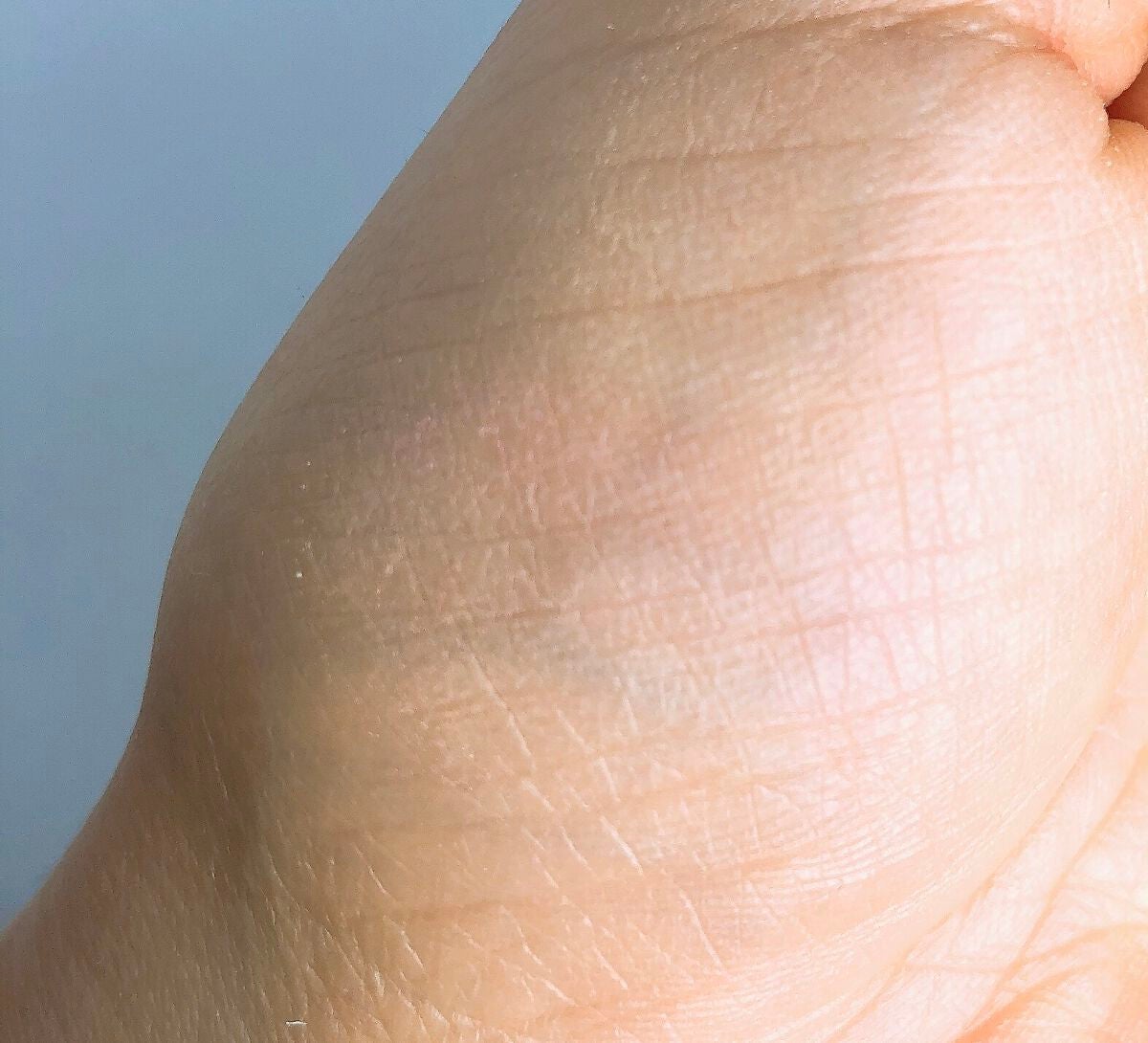 ディエム クルール カラーブレンドパウダーコンシーラー/ディエム クルール/パウダーコンシーラーを使ったクチコミ(4枚目)