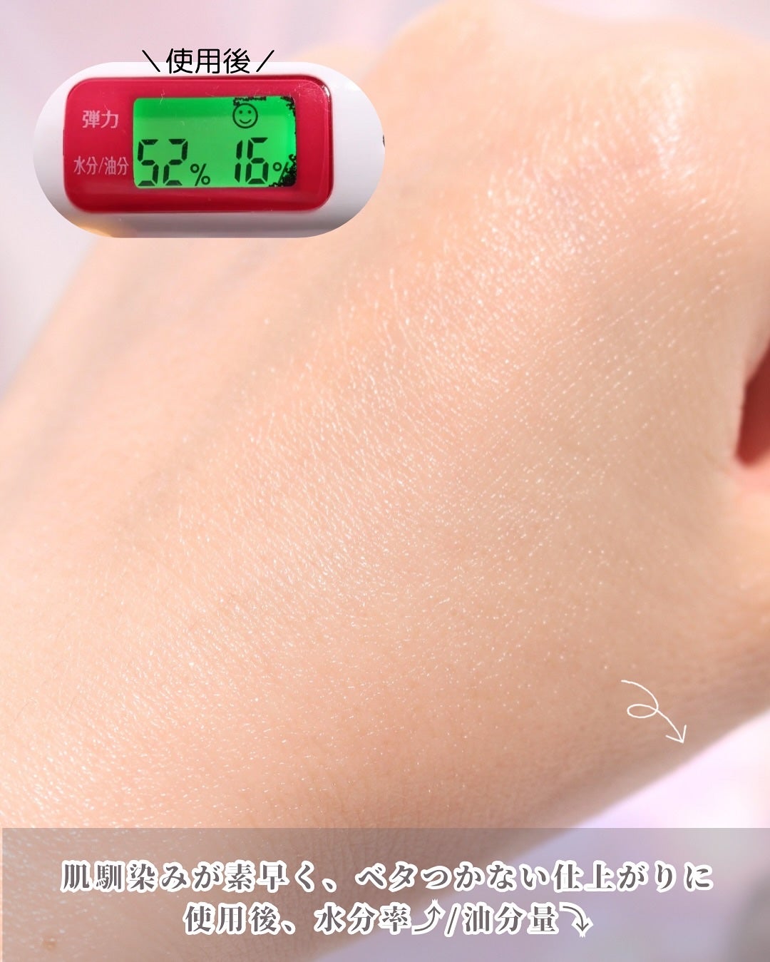 REJURAN ターンオーバーアンプル/REJURAN COSMETICS/美容液を使ったクチコミ(7枚目)