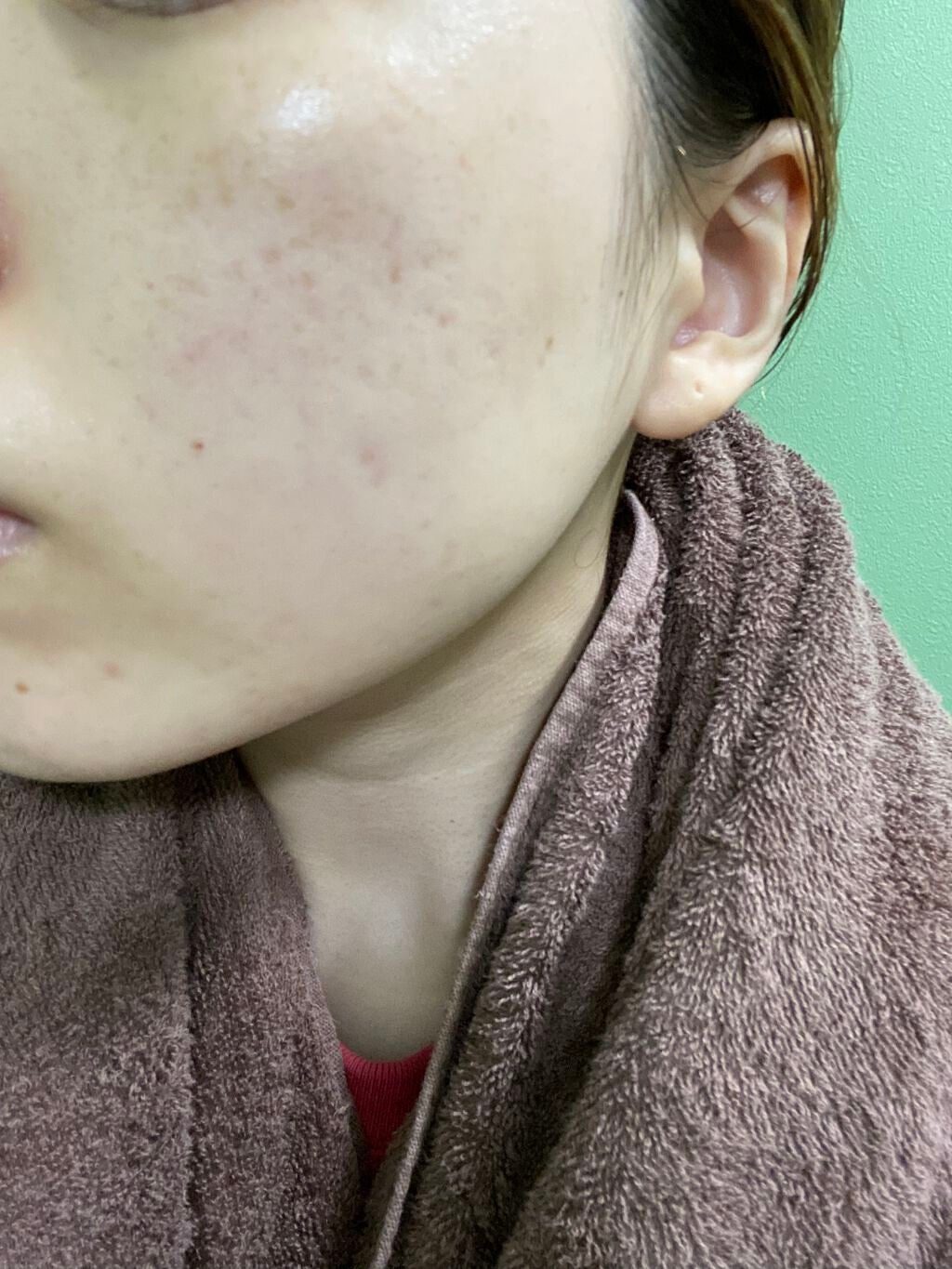 トラブルリペア リキッド/アルージェ/美容液を使ったクチコミ(4枚目)