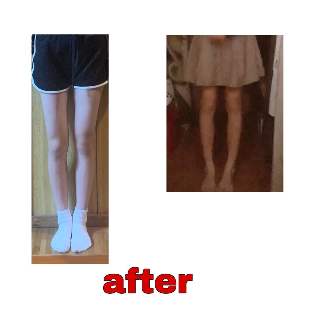 寝ながらメディキュット ロング/メディキュット/着圧ソックス・レギンスを使ったクチコミ(3枚目)