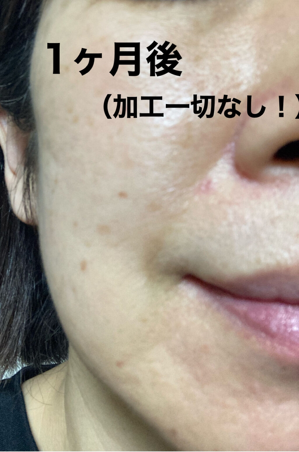 キズを早くきれいに治すパッチ/matsukiyo/その他を使ったクチコミ（2枚目）