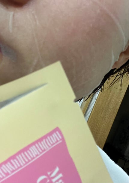 マデセラリアルブルーマスク/SKINRx LAB/シートマスク・パックを使ったクチコミ(6枚目)