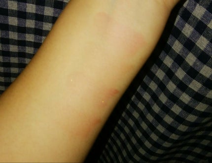 オイルインリップ/セリア/リップグロスを使ったクチコミ(3枚目)