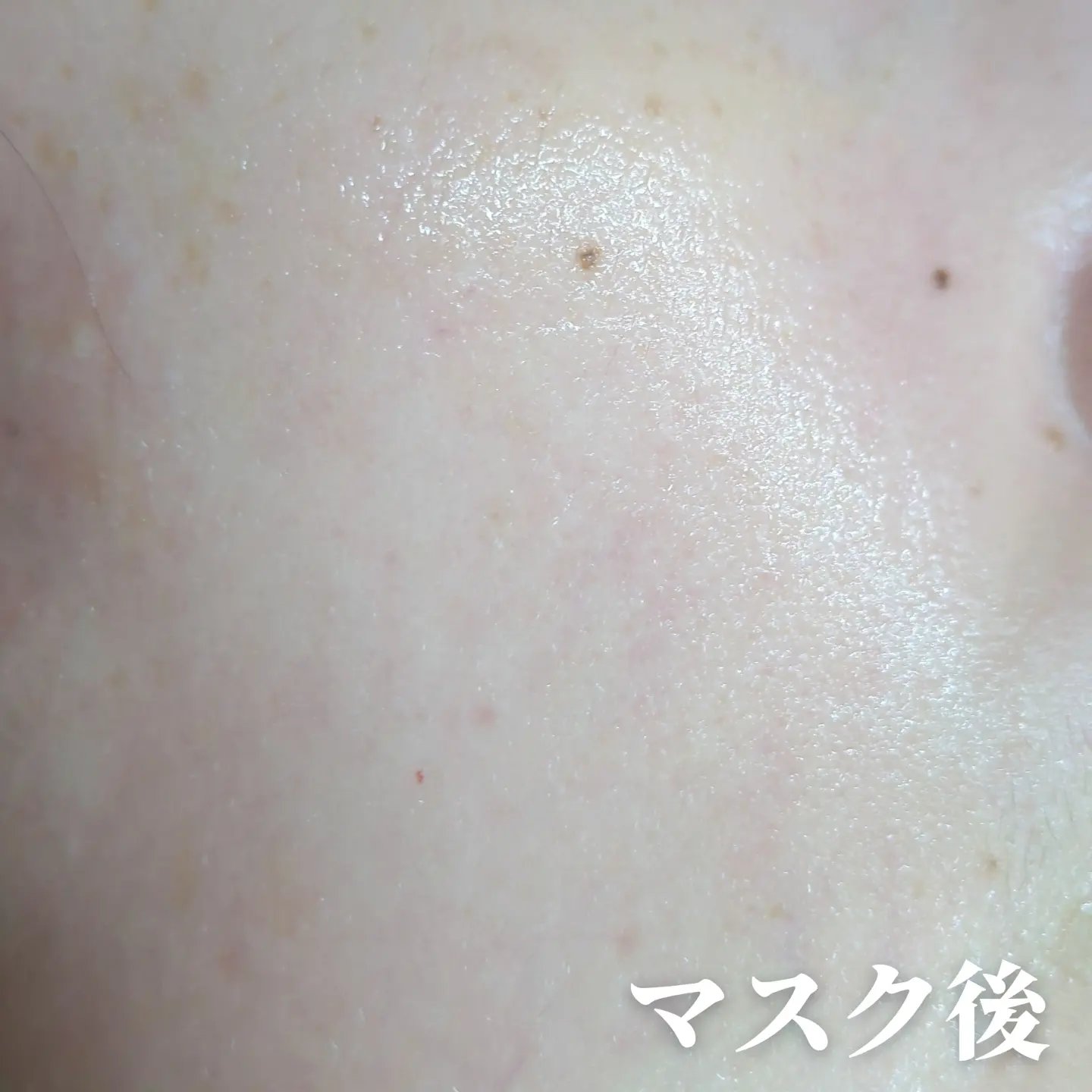 ルルルン ハイドラ V マスク/ルルルン/シートマスク・パックを使ったクチコミ（3枚目）