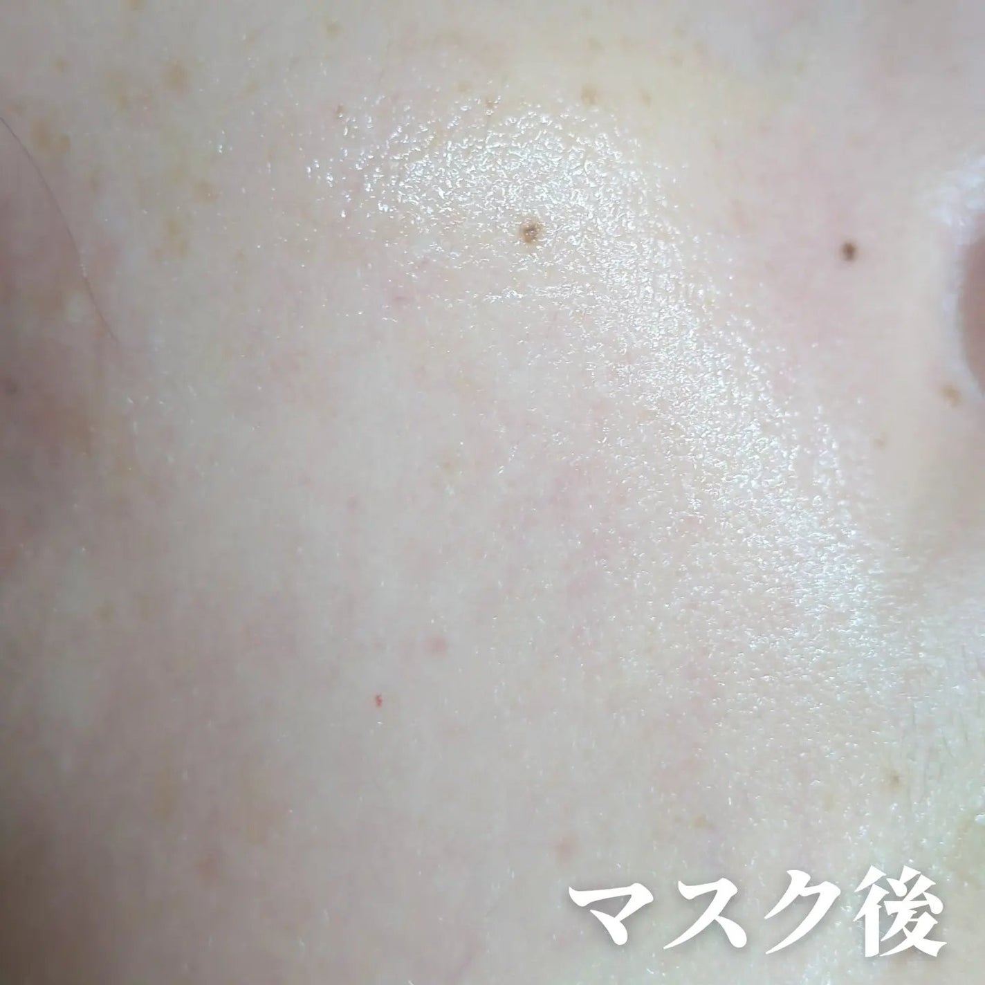 ルルルン ハイドラ V マスク/ルルルン/シートマスク・パックを使ったクチコミ(3枚目)