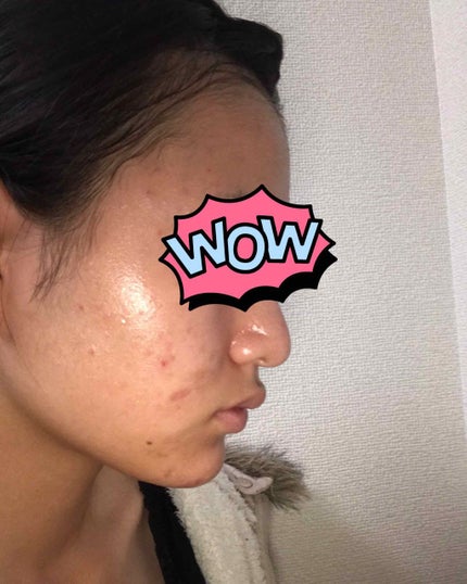 明色美顔水 薬用化粧水/美顔/化粧水を使ったクチコミ(4枚目)