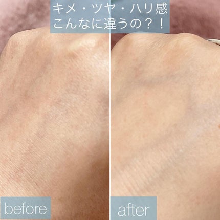 ビタソーダ パウダー/DONNEO/美容液を使ったクチコミ(4枚目)