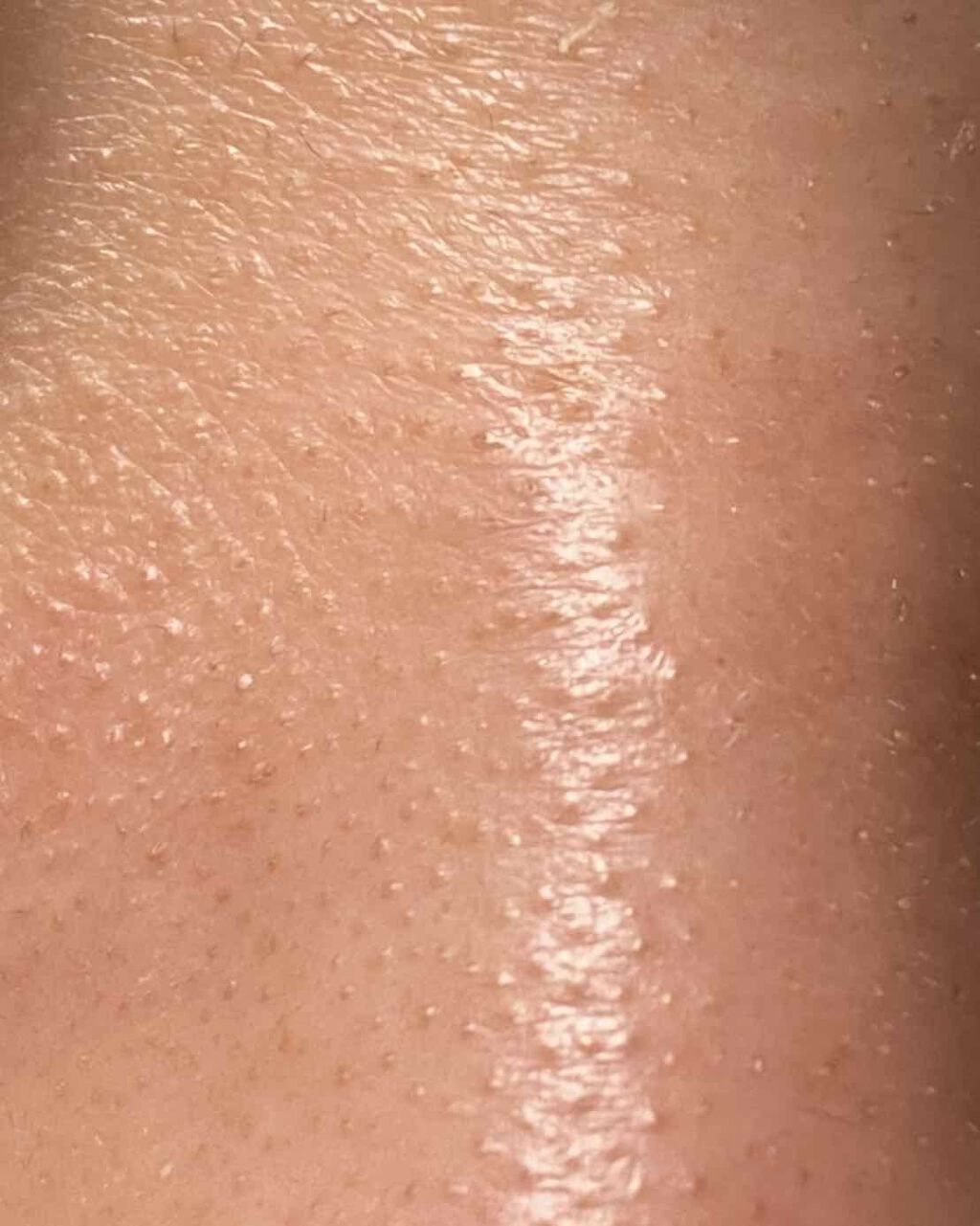 ロゼットゴマージュ/ロゼット/ピーリングを使ったクチコミ(3枚目)