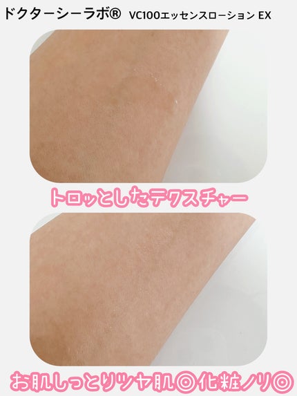 VC100ãšãã»ã³ã¹ããŒã·ã§ã³ EX/ãã¯ã¿ãŒã·ãŒã©ãâ/åç²§æ°Žã䜿ã£ãã¯ãã³ãïŒ2æç®ïŒ