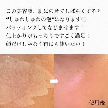 DR.PEPTI ペプチド ボリューム マスター エッセンス





以前LIPSからいただいた試供品を使ってみました！


DR.PEPTIという韓国のブランドのものです🇰🇷


美容液自体はかわいい紫色だけど、肌にのせてしばらくすると“しゅわしゅわの泡”になります。


パッティングして肌になじませます。


仕上がりがもっちりですごく満足です。


顔だけじゃなく首にも使いたい！！！


“塗るボトックス”って言われてるので自分でも購入して続けて使いたい！と思える商品でした。


今使ってる美容液を使い終わったら購入を検討したいと思います！


#LIPSプレゼント #PR #DRPEPTI #ドクターぺプチ #ペプチドボリュームマスターエッセンス #ペプチド #美容液 #スキンケア #韓国コスメ #韓国化粧品 #韓国_スキンケア  #至高のツヤ肌レシピ の画像 その2