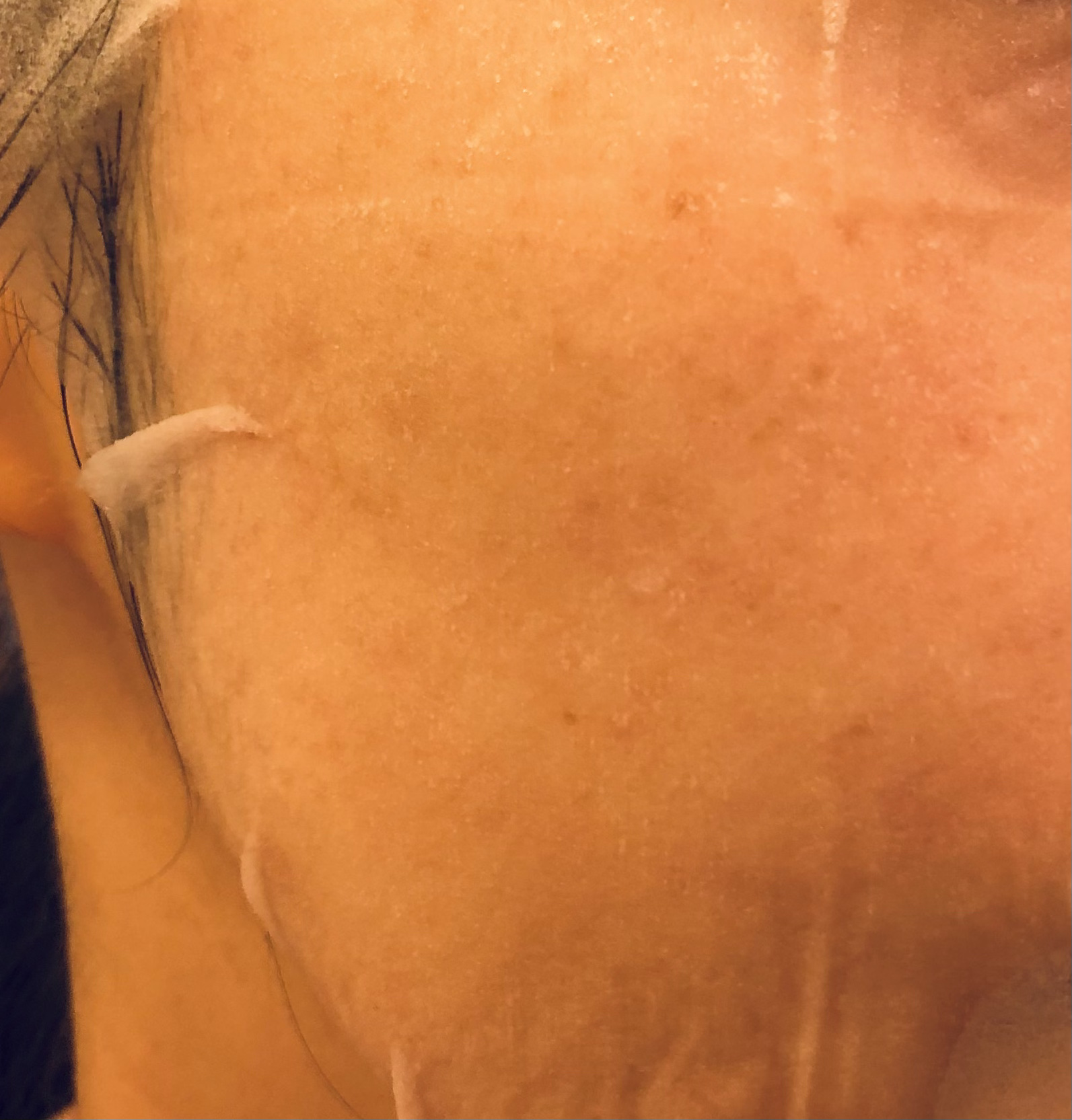 ドクダミトナーデイリーシートマスク/Anua/シートマスク・パックを使ったクチコミ（3枚目）