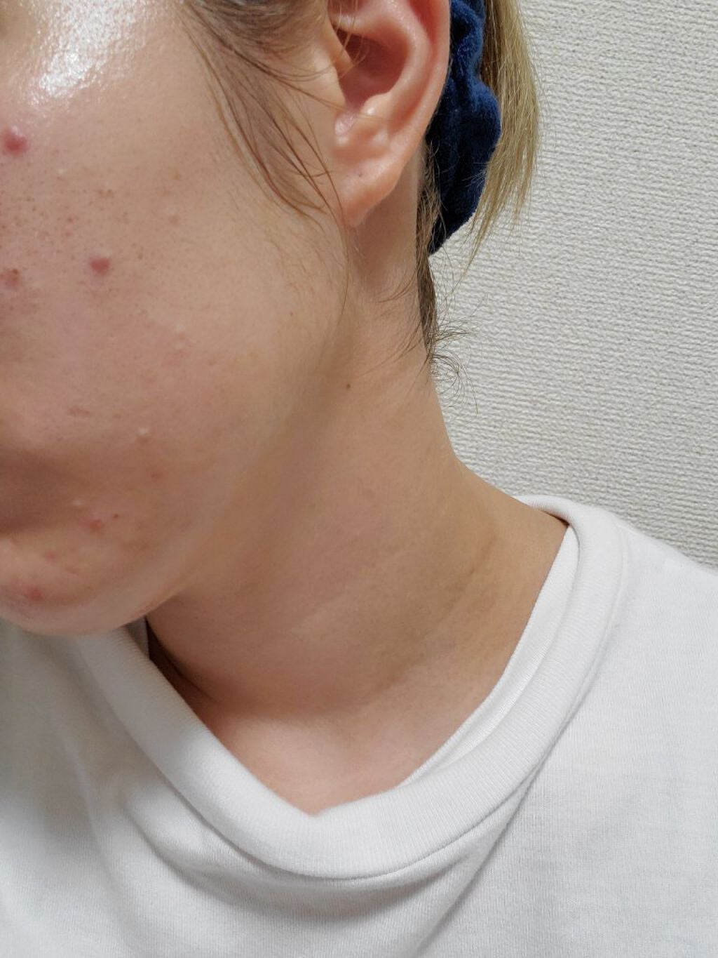 ごめんね素肌マスク/クリアターン/シートマスク・パックを使ったクチコミ(3枚目)