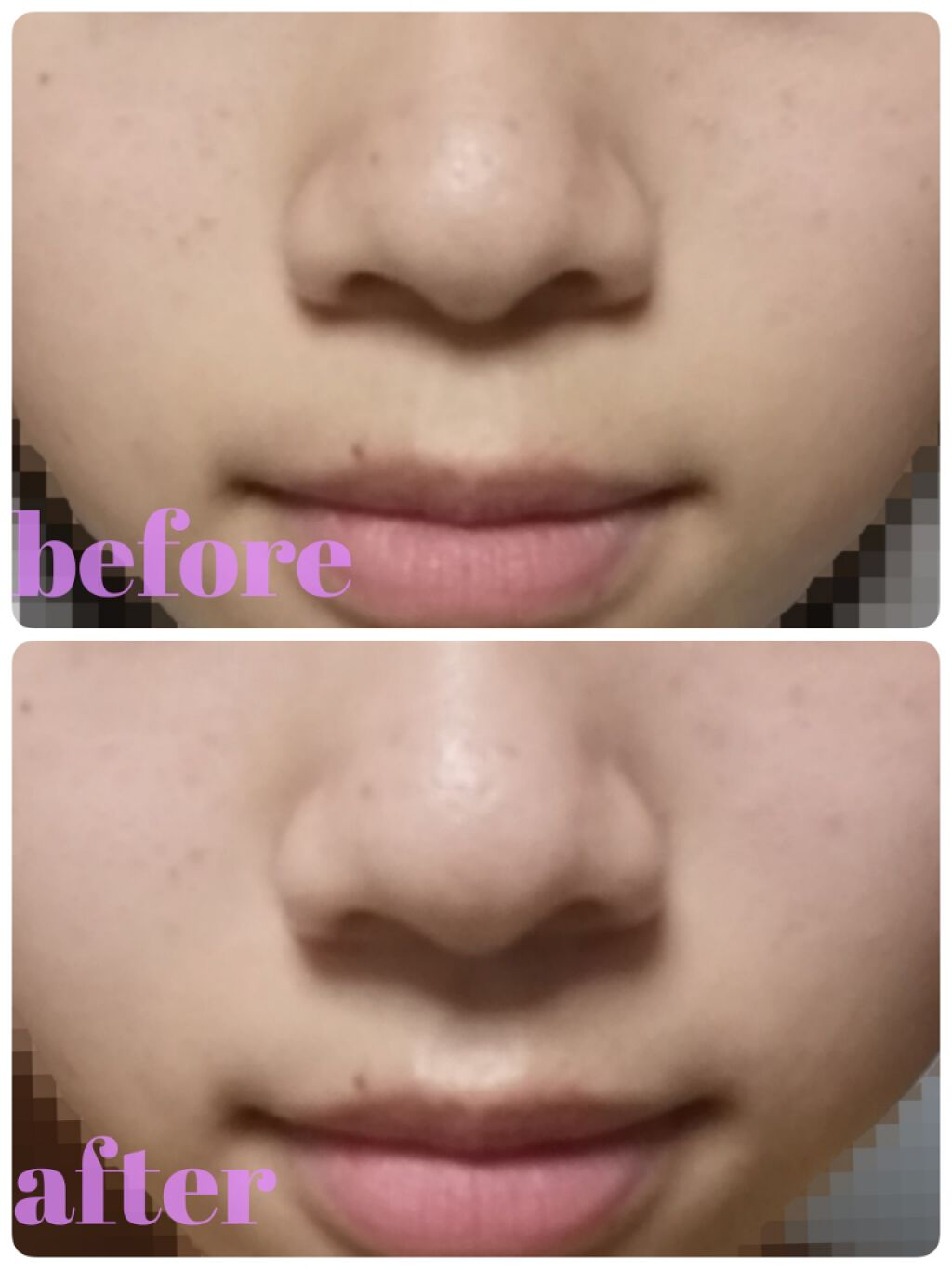 黒真珠マスク/我的美麗日記/シートマスク・パックを使ったクチコミ（3枚目）