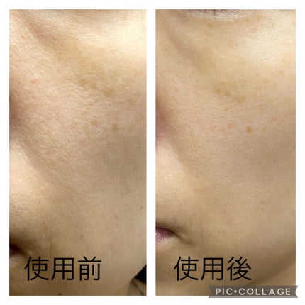 ガラクナイアシン2.0エッセンス/manyo/美容液を使ったクチコミ(2枚目)