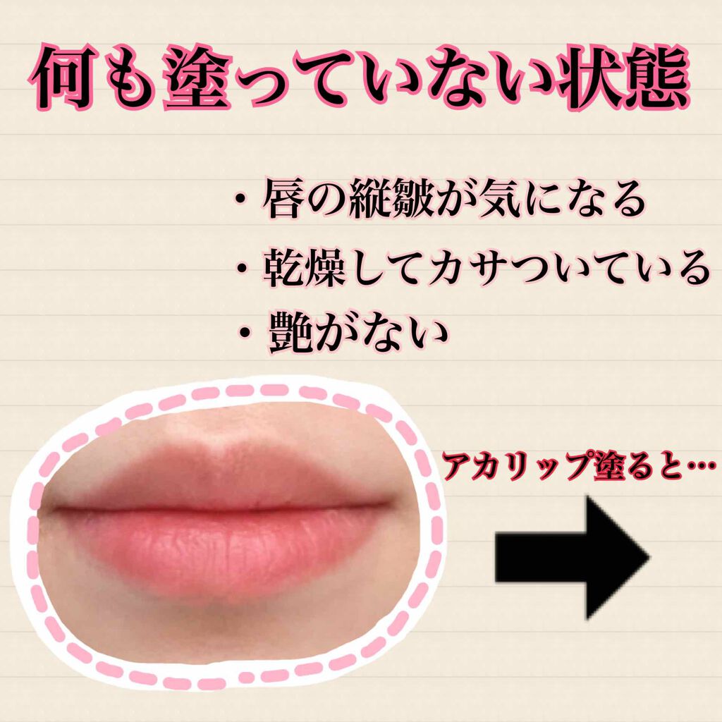 つやぷるリップR/b idol/口紅を使ったクチコミ(2枚目)