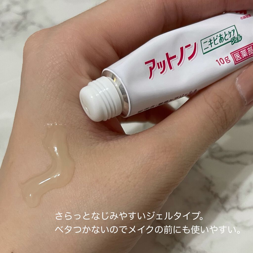 ãããããšã±ã¢ãžã§ã«/ã¢ãããã³/ãã®ä»ã¹ãã³ã±ã¢ã䜿ã£ãã¯ãã³ãïŒ3æç®ïŒ