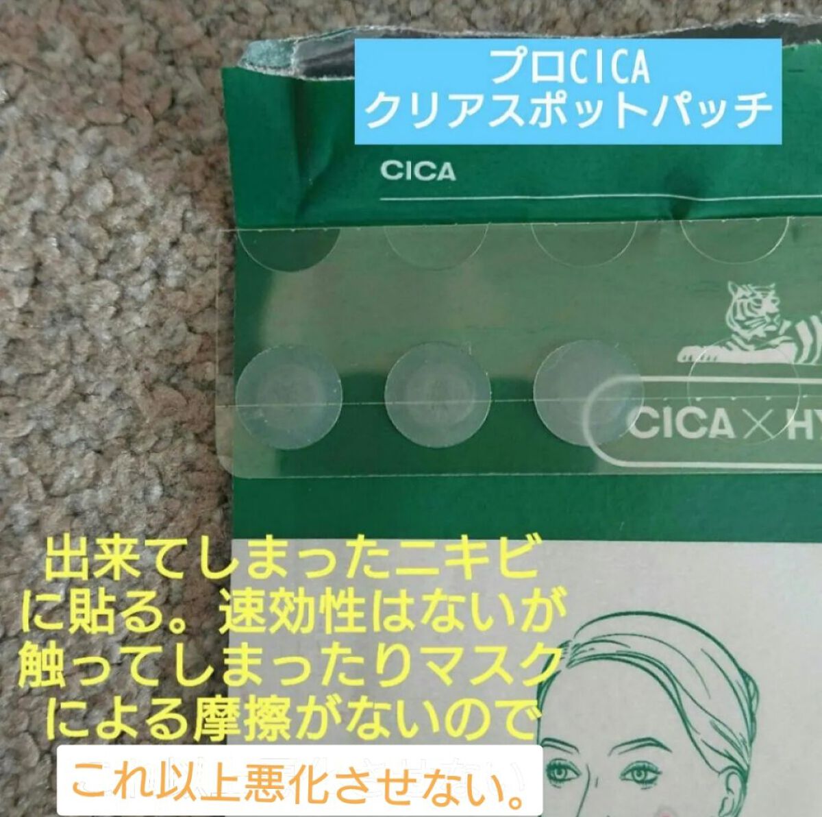 プロCICA クリアスポットパッチ/VT/その他スキンケアを使ったクチコミ（3枚目）