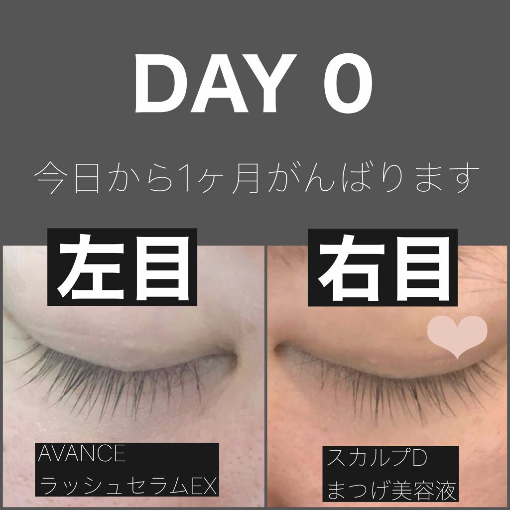 ☆ アヴァンセ ラッシュセラムEX （まつ毛美容液 薬用育毛料）☆