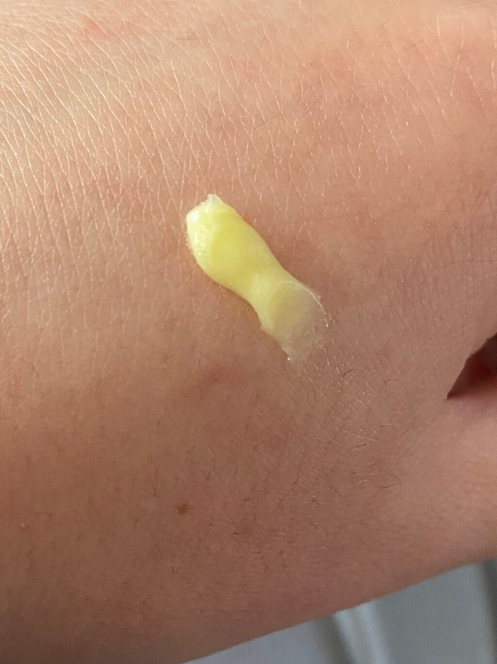 ユースキン/ユースキン/ボディクリームを使ったクチコミ(3枚目)