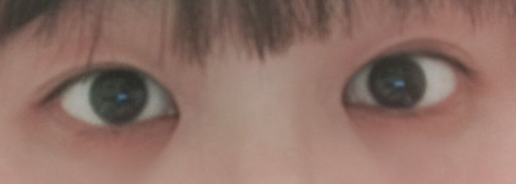 二重まぶた用シール/DAISO/二重まぶた用アイテムを使ったクチコミ（2枚目）