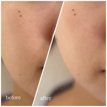 シンクロスキン トーンアップ プライマーコンパクト/SHISEIDO/化粧下地を使ったクチコミ(5枚目)