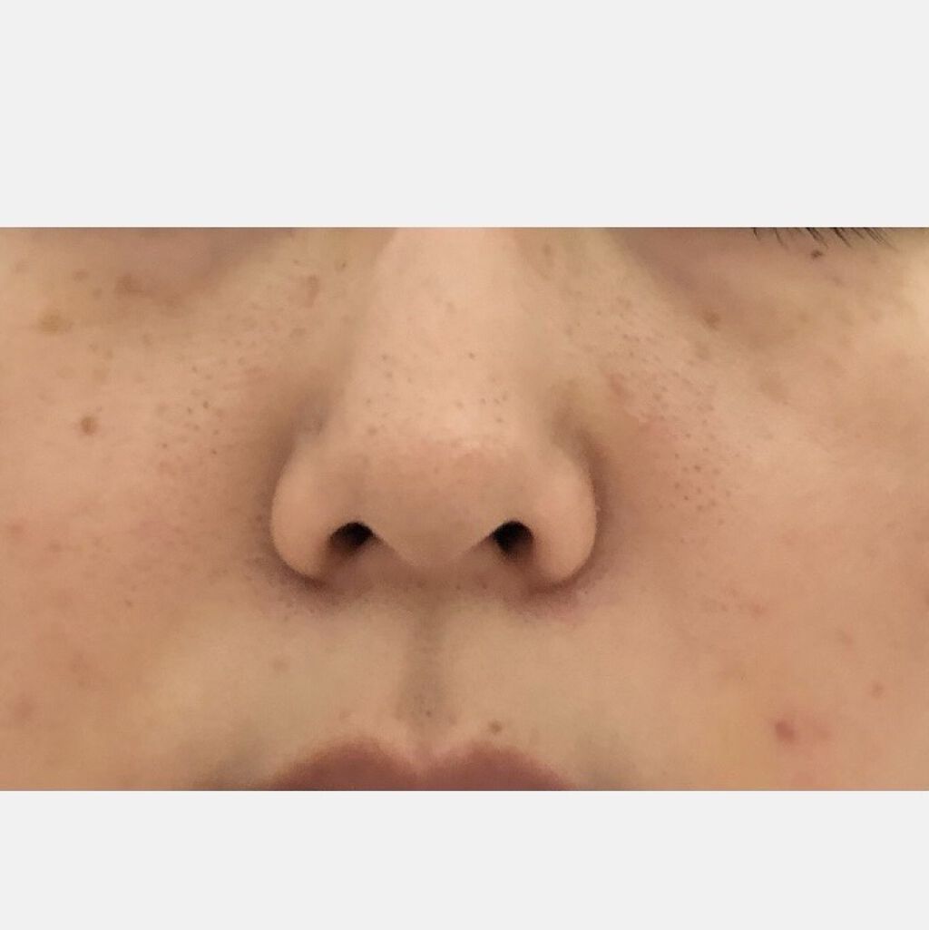 ピュアクリスティ ブレスタシー/ピュアクリスティ/美容液を使ったクチコミ（2枚目）