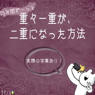 こんにちは🌞
クマノミです🐠



今回はクマノミ🐠が二重になった方法を紹介していきます！


クマノミの元々（二重になる前）の瞼の特徴？形？も踏まえて紹介してきいます😋




二重にな