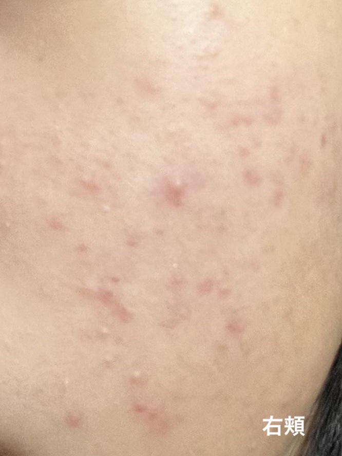 目ざまシート AY 20/サボリーノ/シートマスク・パックを使ったクチコミ（2枚目）