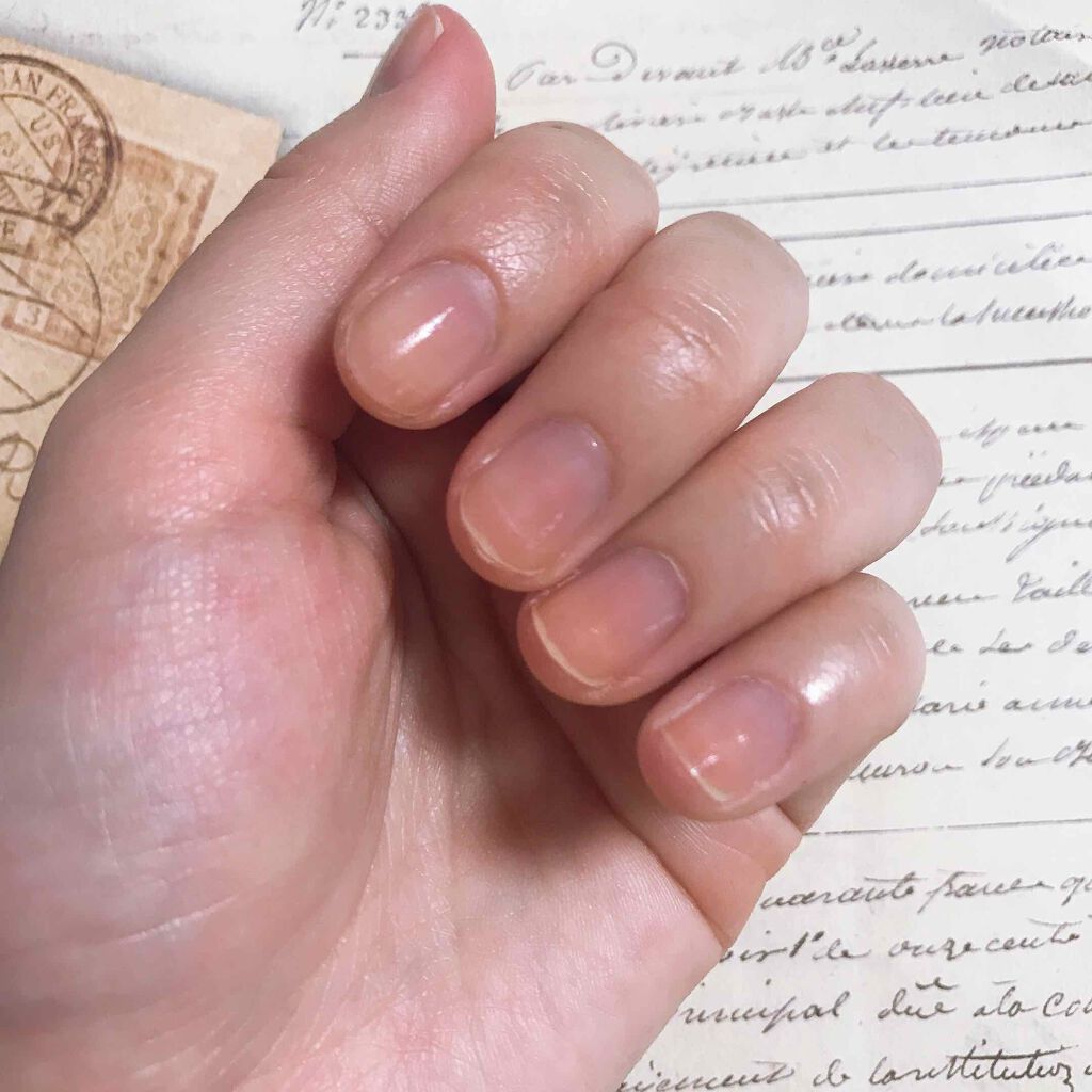 ウィンマックス ネイルケアシリーズ ベースコート/DAISO/ネイルベースコートを使ったクチコミ（2枚目）