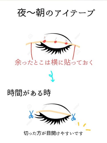 アイテープ片面(のびる)絆創膏タイプ スリム 120枚/セリア/二重まぶた用アイテムを使ったクチコミ（2枚目）