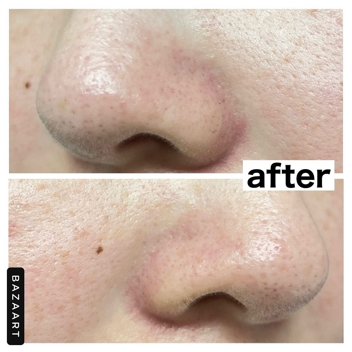 ナチュラルマイルドクリアノーズパック/ilso/シートマスク・パックを使ったクチコミ(8枚目)