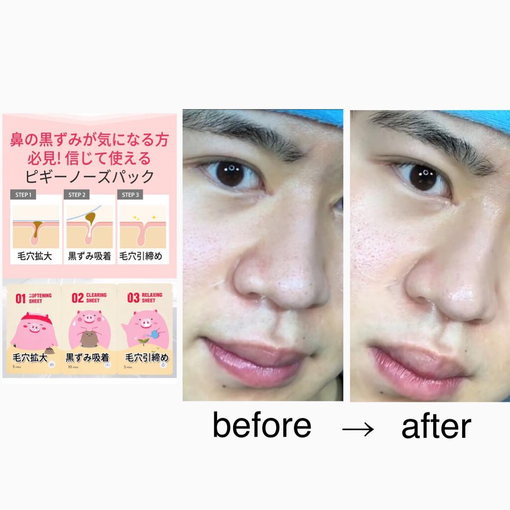 しまきょ〜💄正直レビュー on LIPS 「before→after・【商品名】3steppiggynos..」(1枚目)