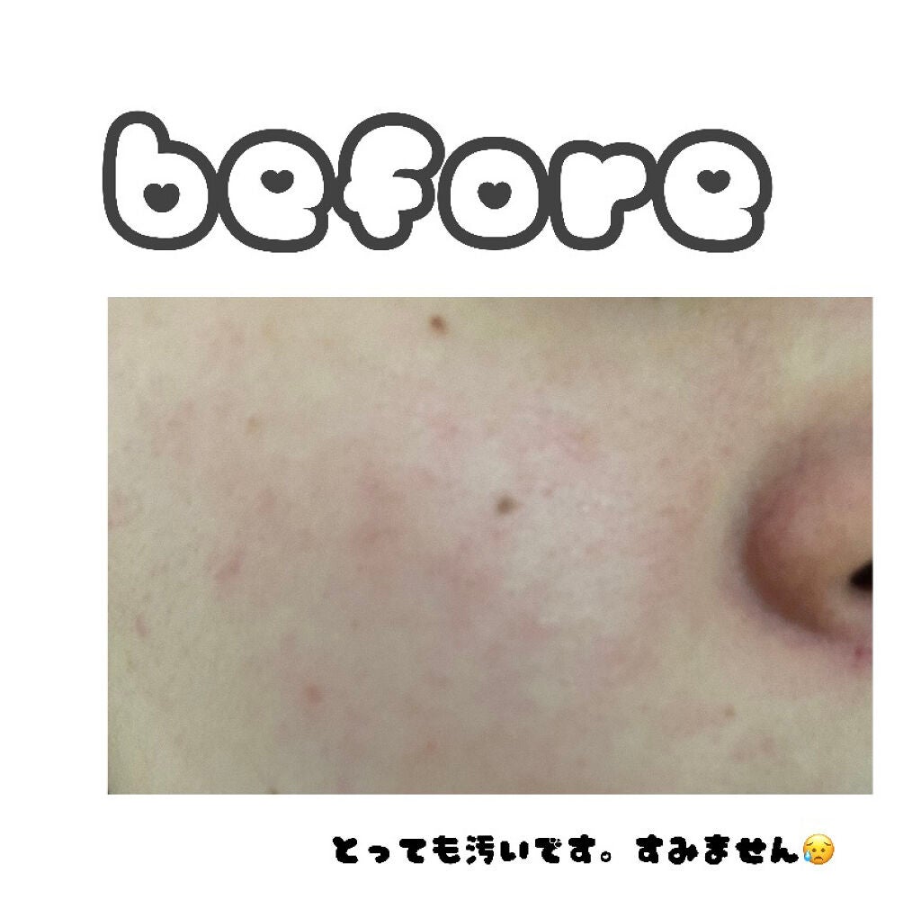 炭酸泡クレンジングパック/piera(ピエラ)/洗い流すパック・マスクを使ったクチコミ(5枚目)