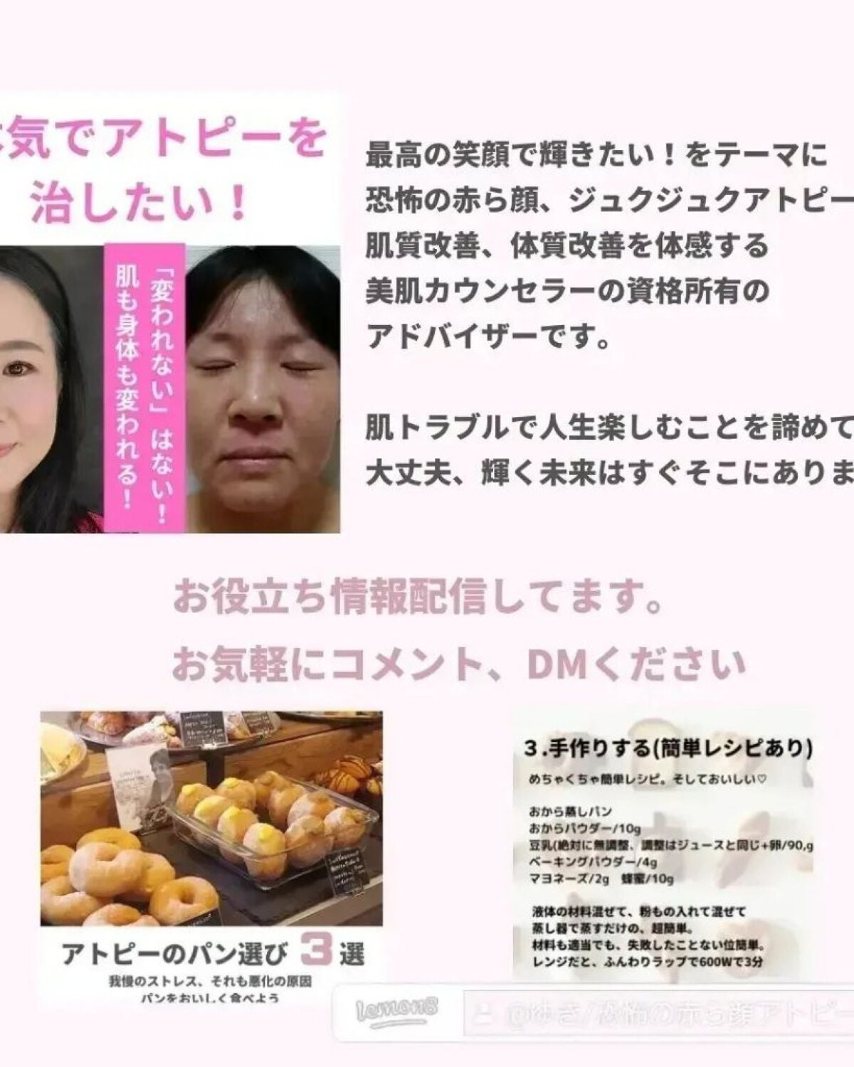 美肌カウンセラー💆肌悩みを解決し見る世界を変える on LIPS 「アトピーやニキビ改善の必須条件"腸内環境の改善"🌱昔の..」(10枚目)