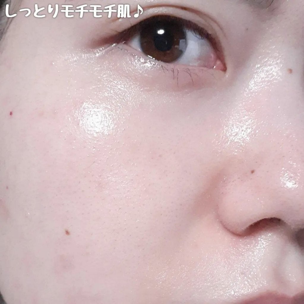 レッドブレミッシュ クリアスージングクリーム/Dr.G/フェイスクリームを使ったクチコミ(7枚目)